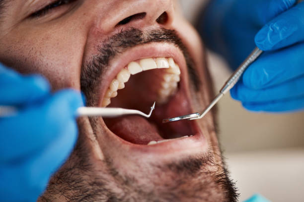Best Pediatric Emergency Dentist in Yazoo City, MS