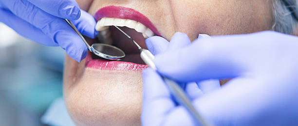 Best Emergency Dental Extractions in Yazoo City, MS